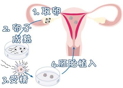 供卵联系方式
